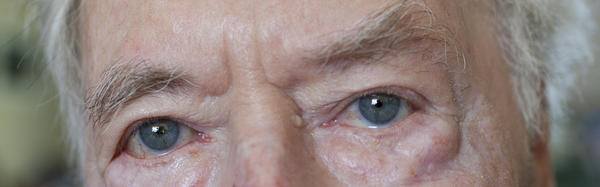 photograph of a man's eyes